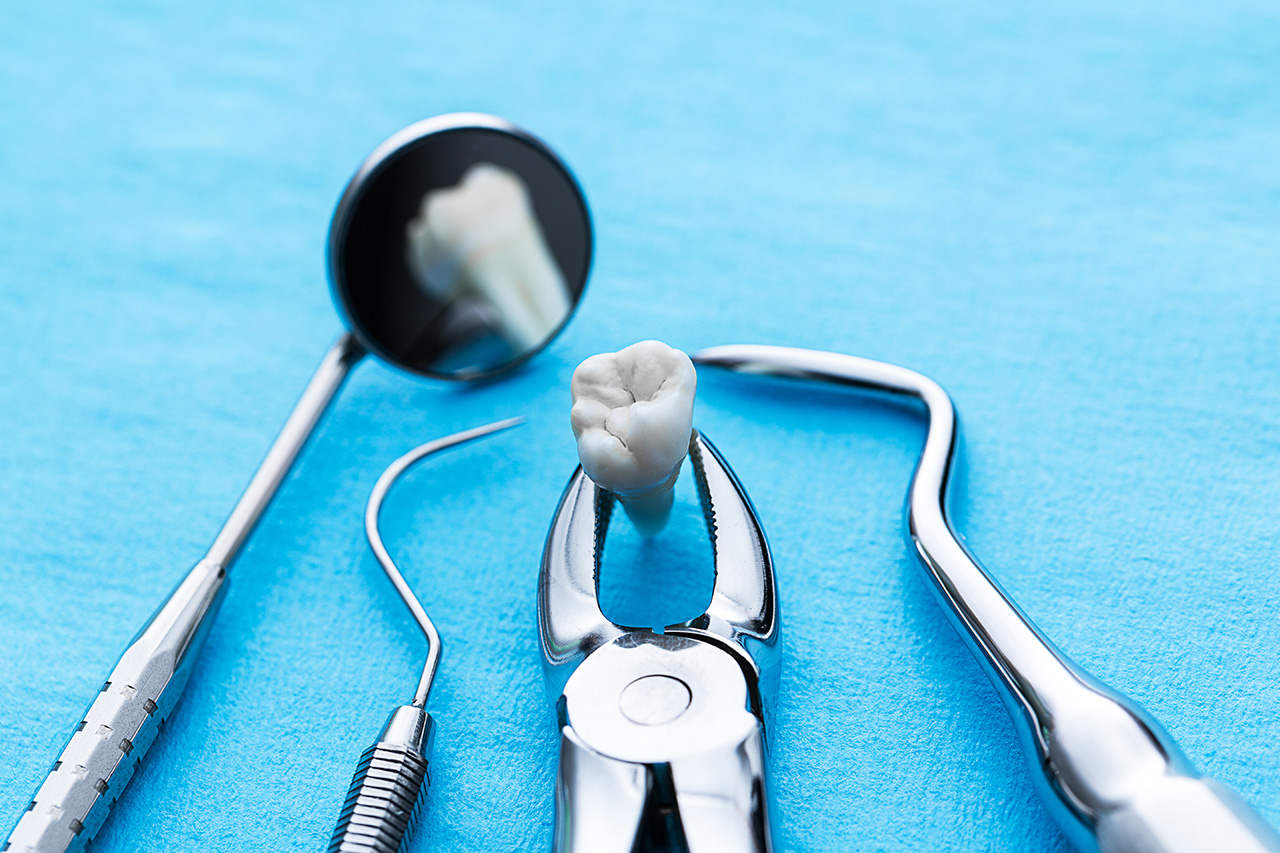 tooth-extraction-and-implant-integrativemedalliance